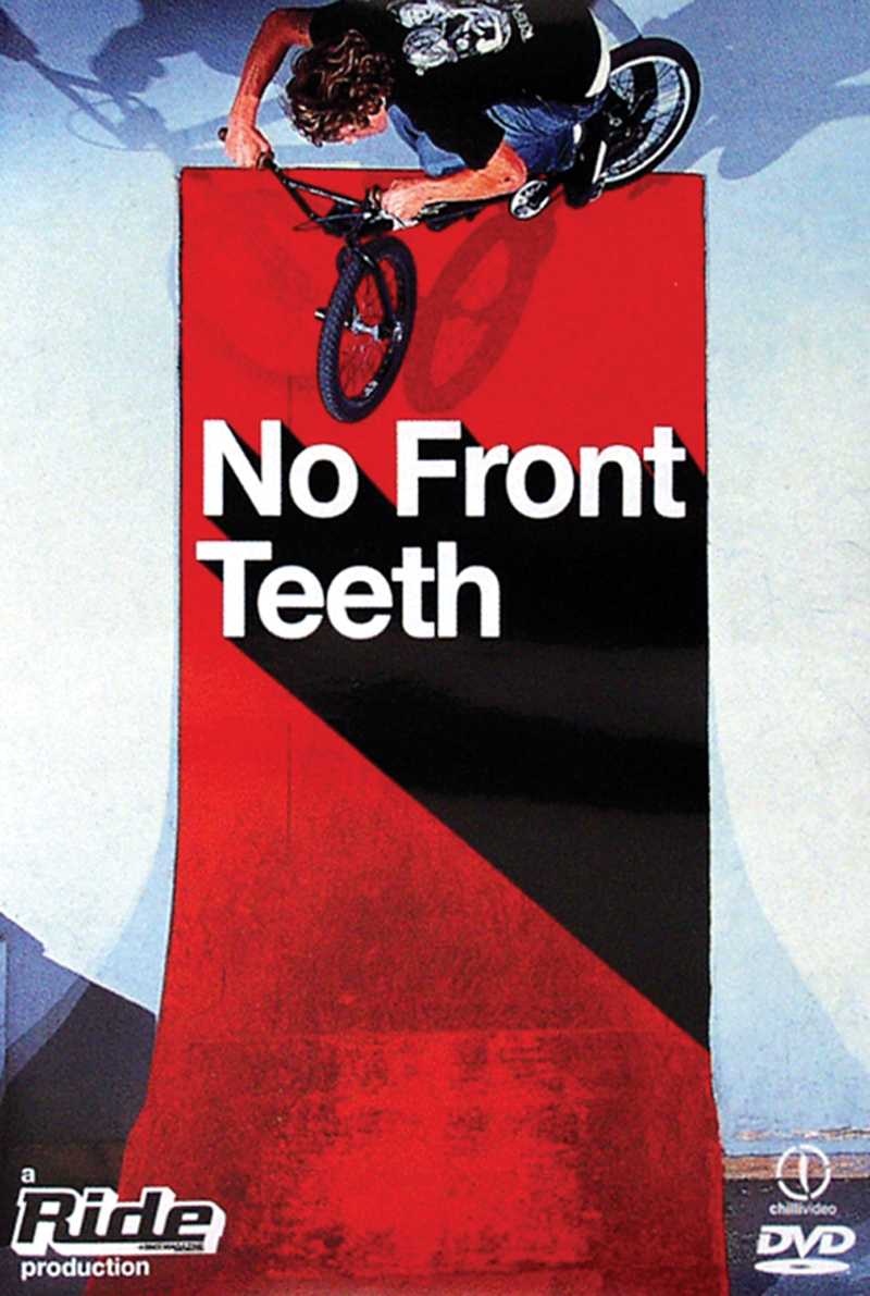 No Front Teeth DVD Duke Video